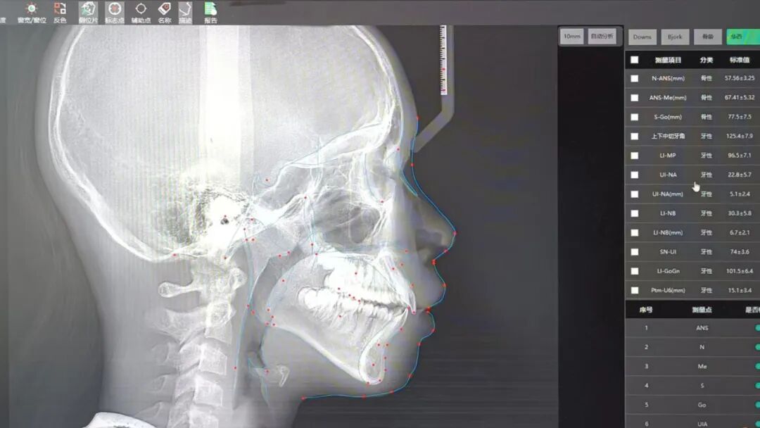 种植牙/正畸不用慌！我院口腔CT，给你看得见的精准守护