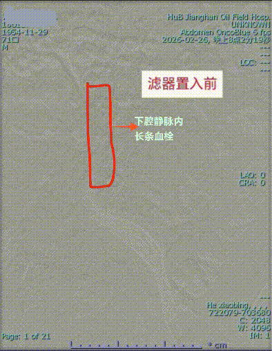 mmexport1772696457585.gif