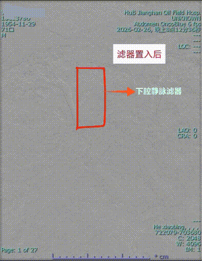 mmexport1772696591447.gif